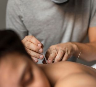 Originea Milenară a Acupuncturii: O Privire la Istoria sa Lungă și Complexă