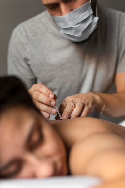 Originea Milenară a Acupuncturii: O Privire la Istoria sa Lungă și Complexă